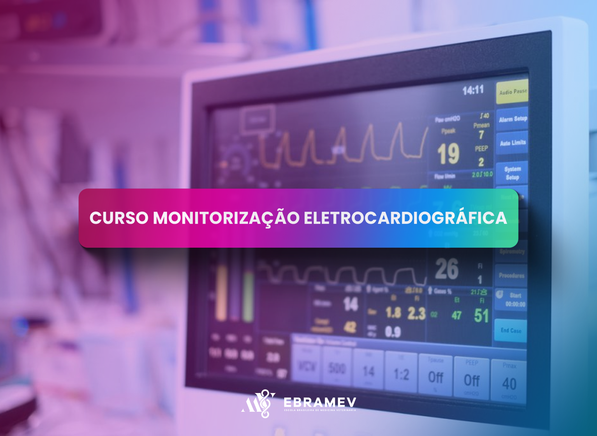 MONITORAO ELETROCARDIOGRFICA